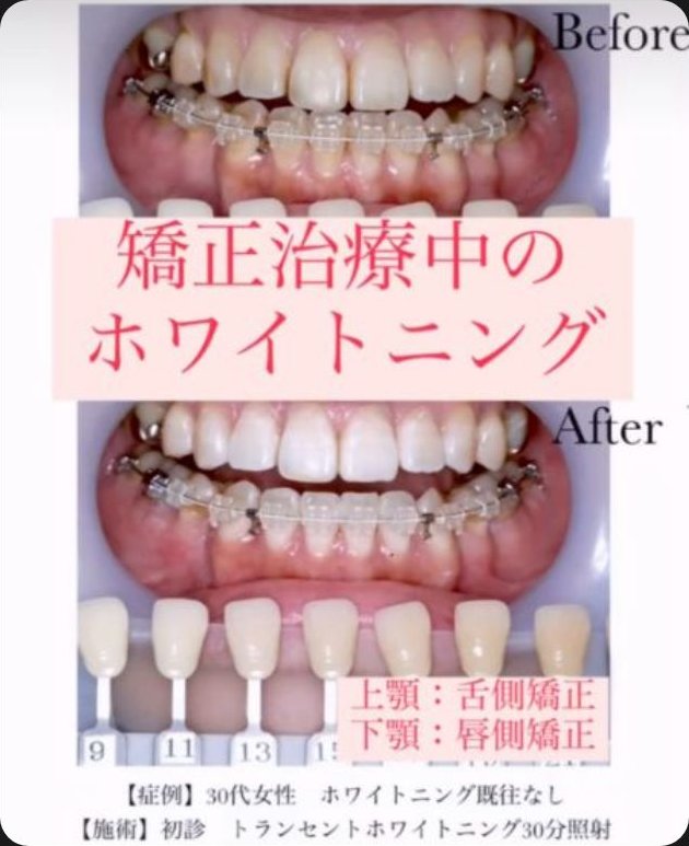 ルーセント歯科・矯正歯科の配信画像 2